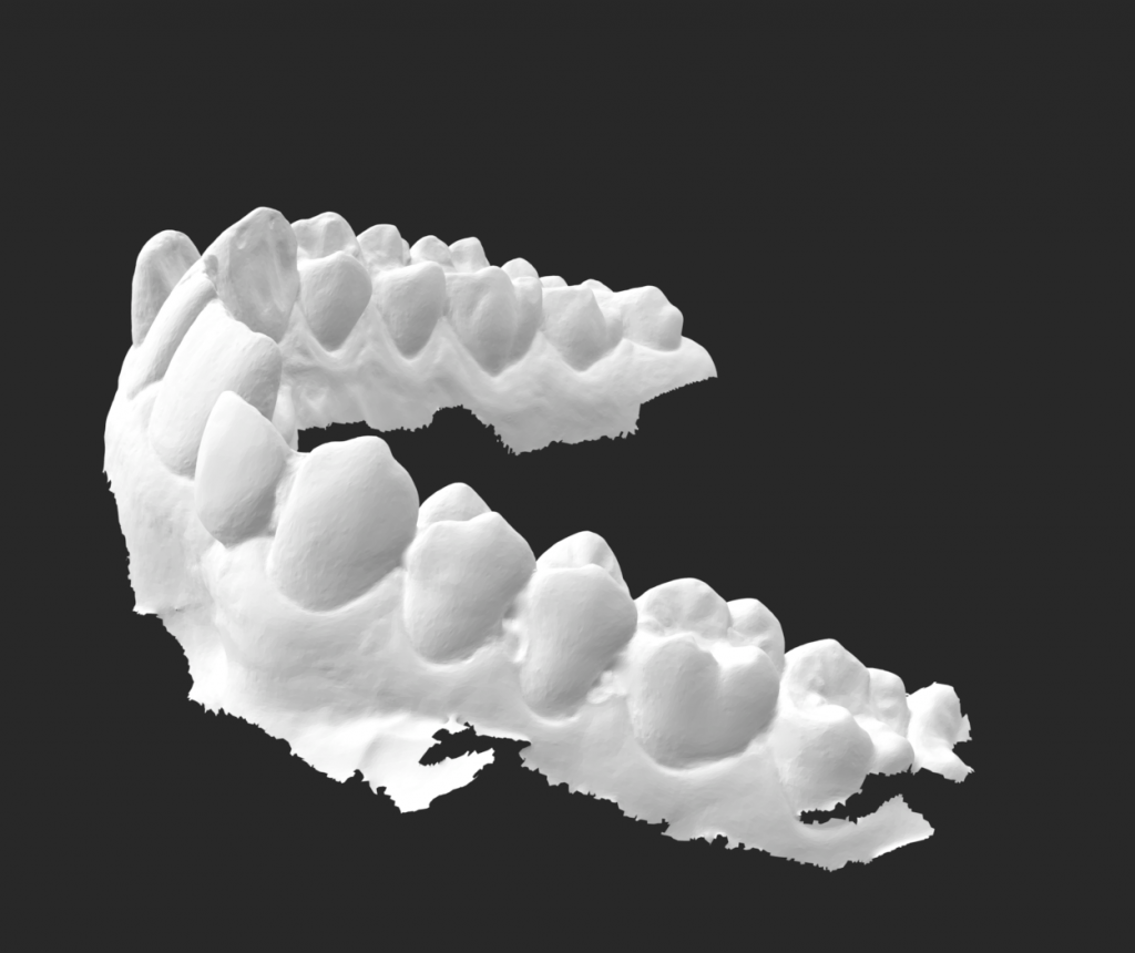 Rough scan of teeth.